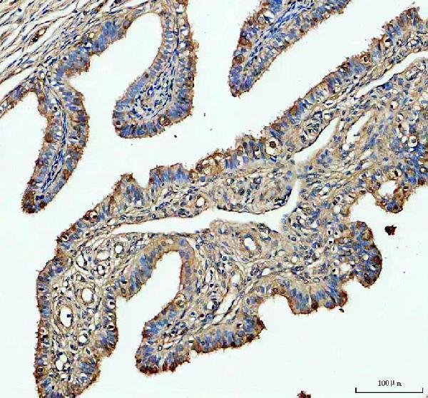 IHC analysis of FAM161A using anti-FAM161A antibody (A06948-1)