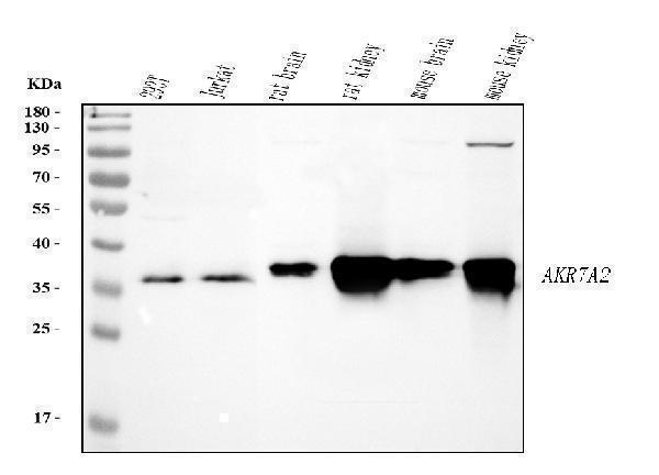 Western blot analysis of AKR7A2 using anti-AKR7A2 antibody (A06949-1)