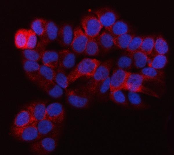 a06953 1 qars1 primary antibodies if testing 6