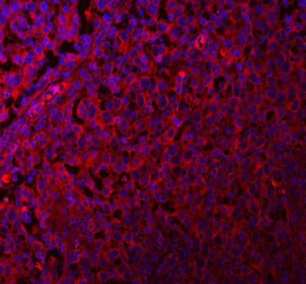 a06953 1 qars1 primary antibodies if testing 7