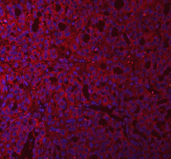a06953 1 qars1 primary antibodies if testing 8