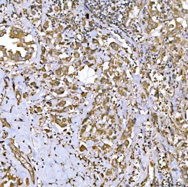 a06953 1 qars1 primary antibodies ihc testing 3