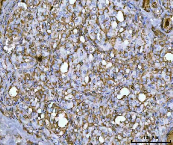 a06953 1 qars1 primary antibodies ihc testing 5