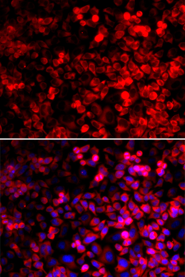 a06953 qars primary antiboties ihc testing 2