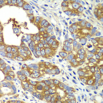 a06953 qars primary antiboties ihc testing 4