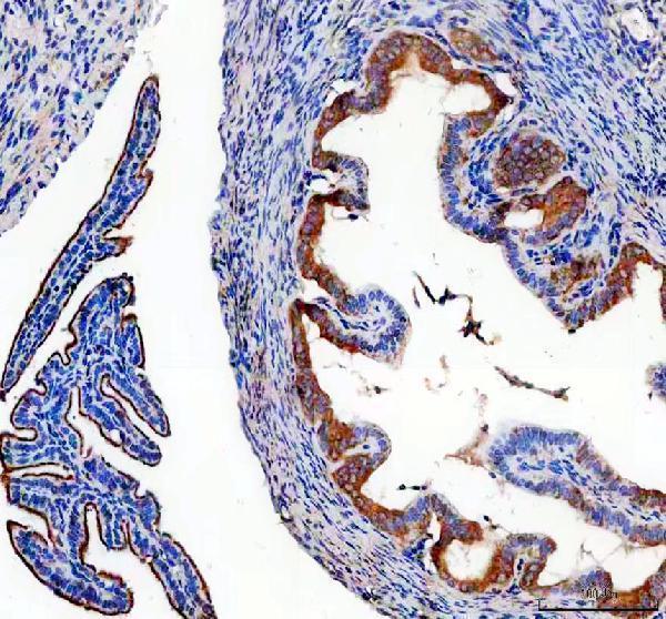 IHC analysis of ARHI/DIRAS3 using anti-ARHI/DIRAS3 antibody (A06954-2)