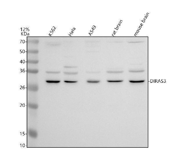 Western blot analysis of ARHI/DIRAS3 using anti-ARHI/DIRAS3 antibody (A06954-2)