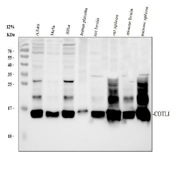 Western blot analysis of -COTL1 using anti-COTL1 antibody (A06956-1)
