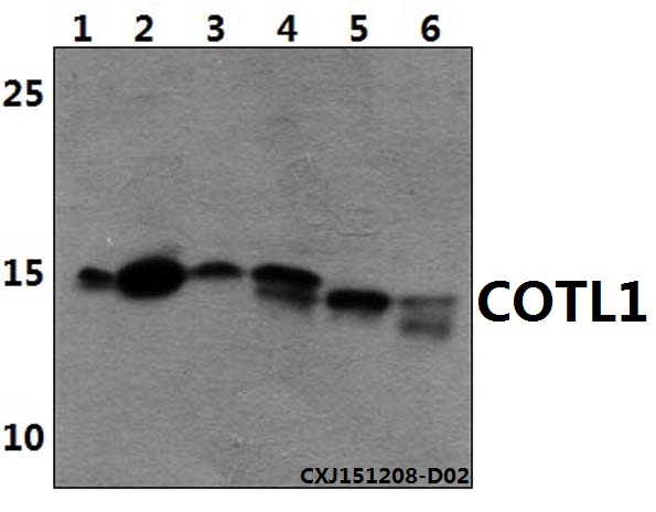 Western blot (WB) analysis of COTL1 polyclonal antibody at 1:500 dilution
Lane1:HEK293T whole cell lysate(40ug)
Lane2:A549 whole cell lysate(40ug)
Lane3:The lung tissue lysate of Mouse(30ug)
Lane4:The lung tissue lysate of Rat(30ug)
Lane5:The kidney tissue lysate of Mouse(30ug)
Lane6:The kidney tissue lysate of Rat(30ug)