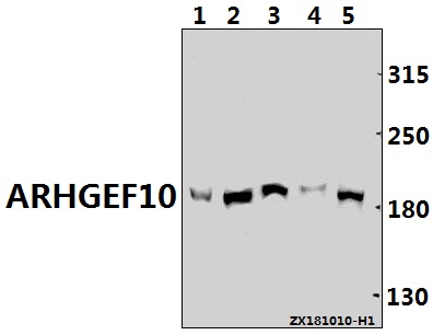 a06958 1 arhgef10 primary antiboties wb testing 1