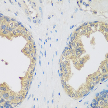 Immunohistochemistry of paraffin-embedded rat kidney using ENPEP antibody  at dilution of 1:200 