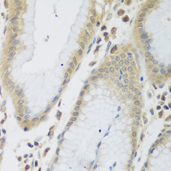 Immunohistochemistry of paraffin-embedded human prostate using ENPEP antibody  at dilution of 1:200 