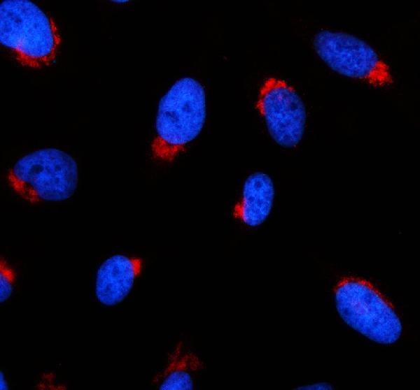 IF analysis of GRHPR using anti-GRHPR antibody (A06963-1)