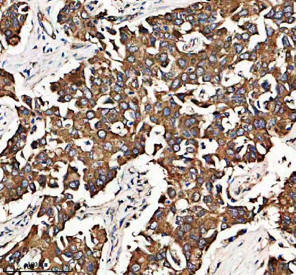 IHC analysis of GRHPR using anti-GRHPR antibody (A06963-1)