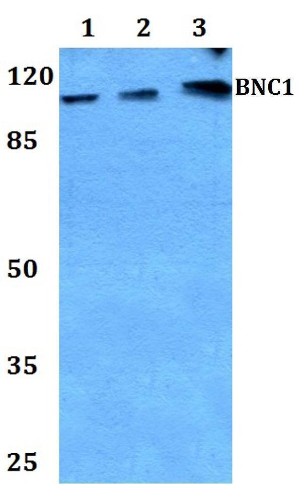a06966 1 bnc1 primary antiboties wb testing 1