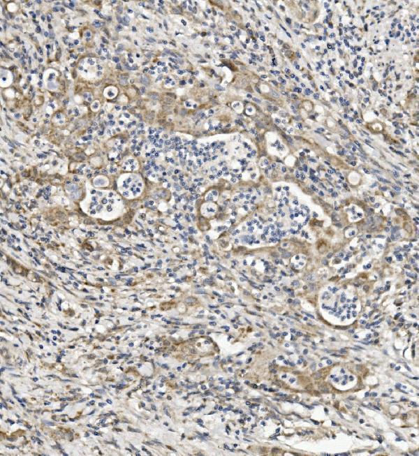 a06967 1 sema6a primary antibodies ihc testing 2
