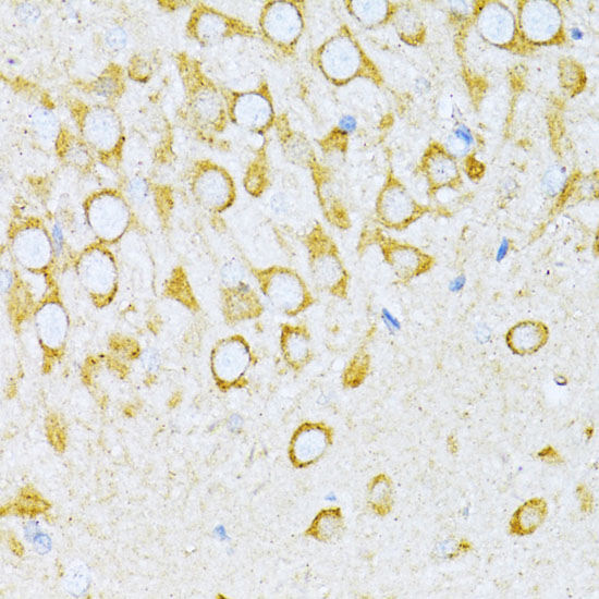 a06970 vars primary antiboties ihc testing 2