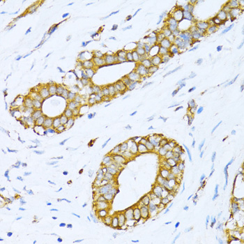 a06970 vars primary antiboties ihc testing 3