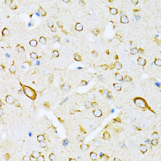 a06970 vars primary antiboties ihc testing 4