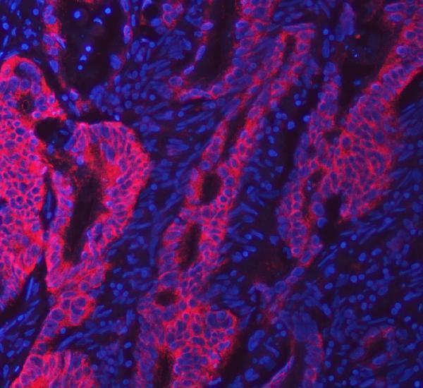 a06972 3 swap70 primary antibodies if testing 4