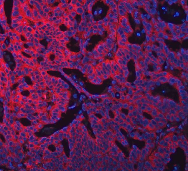 a06972 3 swap70 primary antibodies if testing 5