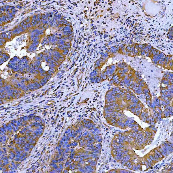 a06972 3 swap70 primary antibodies ihc testing 3