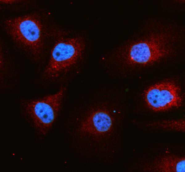 a06974 1 uqcrc1 primary antibodies if testing 1