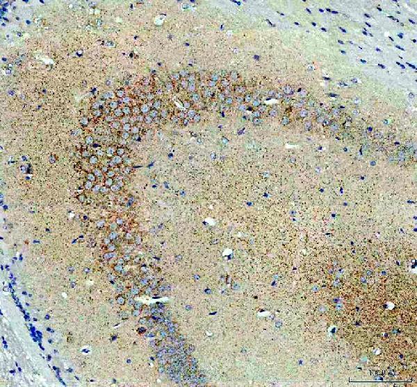 a06974 1 uqcrc1 primary antibodies ihc testing 11