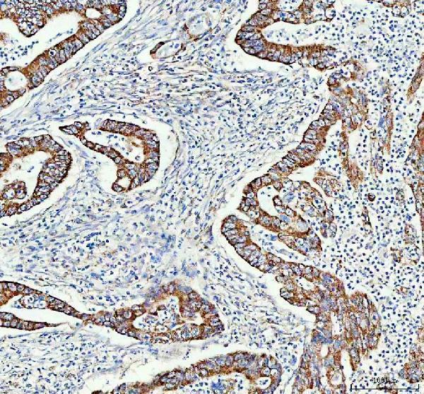  IHC analysis of UQCRC1 using anti-UQCRC1 antibody (A06974-1)