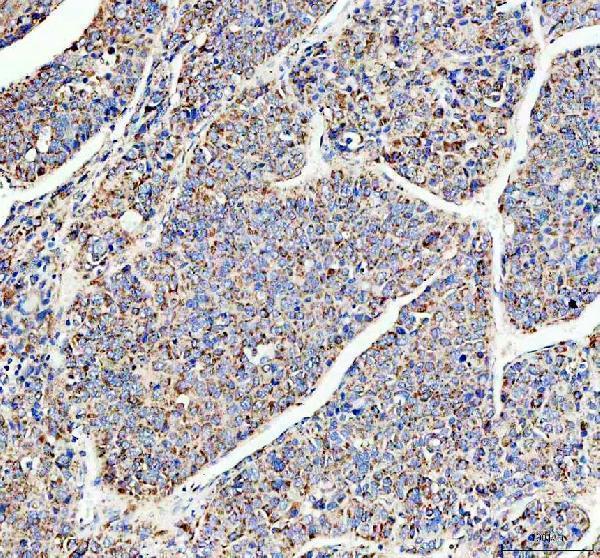  IHC analysis of UQCRC1 using anti-UQCRC1 antibody (A06974-1)