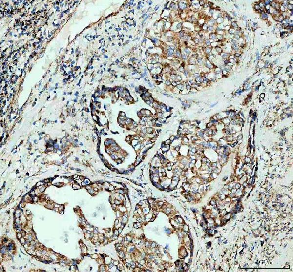 a06974 1 uqcrc1 primary antibodies ihc testing 4