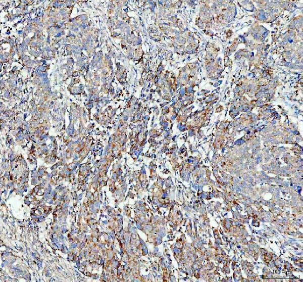 a06974 1 uqcrc1 primary antibodies ihc testing 5