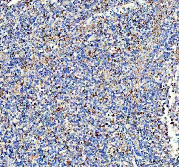 a06974 1 uqcrc1 primary antibodies ihc testing 6