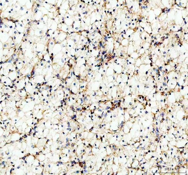 a06974 1 uqcrc1 primary antibodies ihc testing 7