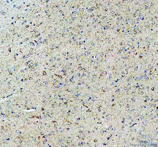a06974 1 uqcrc1 primary antibodies ihc testing 8