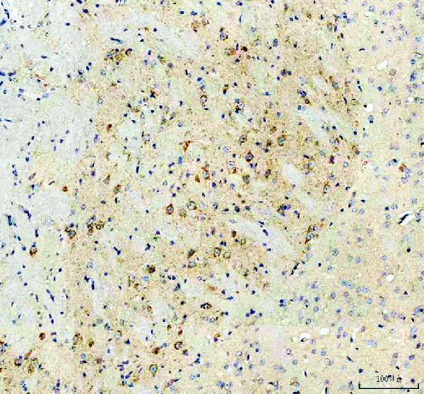a06974 1 uqcrc1 primary antibodies ihc testing 9