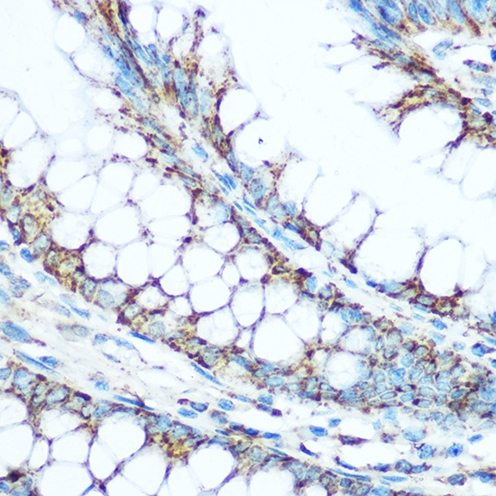 Immunohistochemistry of paraffin-embedded human colon using UQCRC1 Rabbit pAb  at dilution of 1:100 