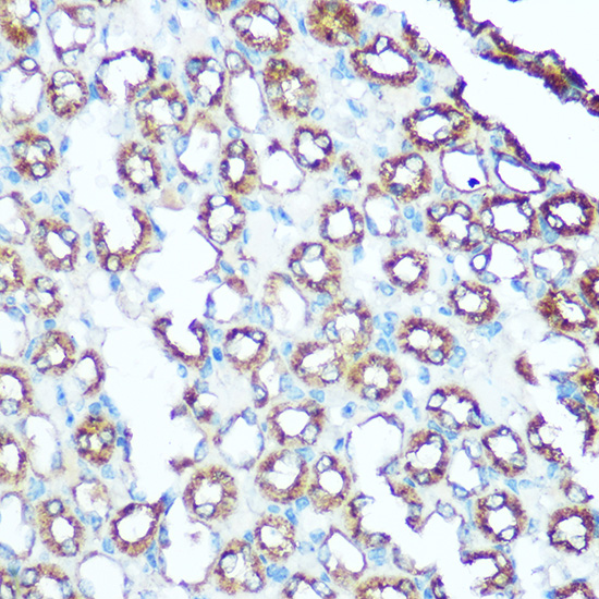 Immunohistochemistry of paraffin-embedded mouse kidney using UQCRC1 Rabbit pAb  at dilution of 1:100 