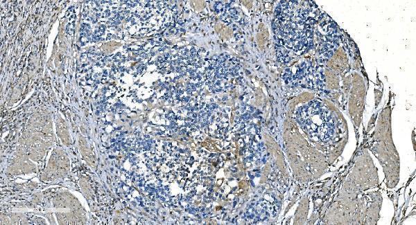 a06975 1 gng2 primary antibodies ihc testing 3
