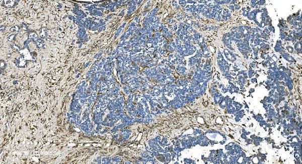 a06975 1 gng2 primary antibodies ihc testing 6