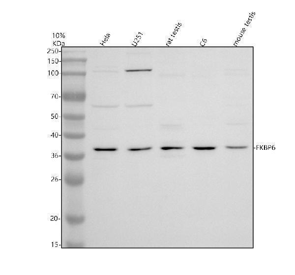 Western blot analysis of FKBP6 using anti-FKBP6 antibody (A06977-1)