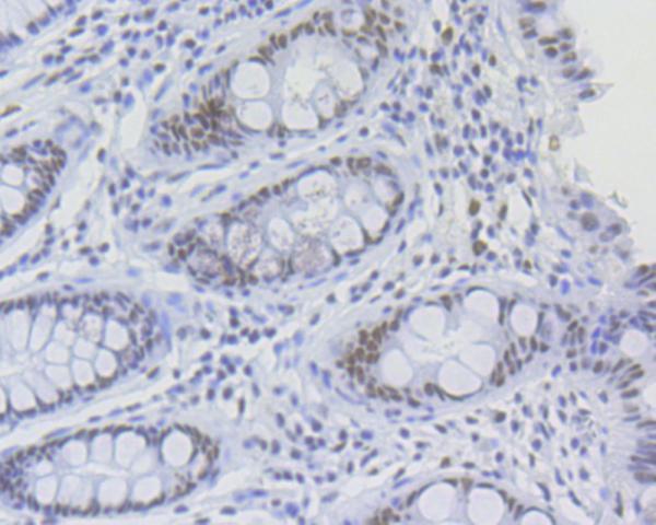 Immunohistochemical analysis of paraffin-embedded human tonsil tissue using anti-RNF40 antibody