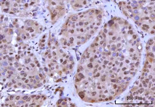  IHC analysis of RNF40 using anti-RNF40 antibody (A06979-2)