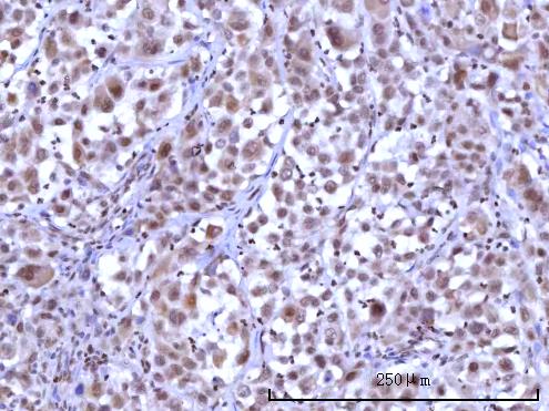  IHC analysis of RNF40 using anti-RNF40 antibody (A06979-2)