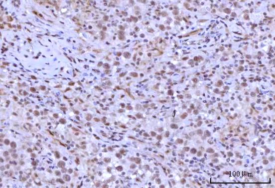 a06979 2 rnf40 primary antibodies ihc testing 4