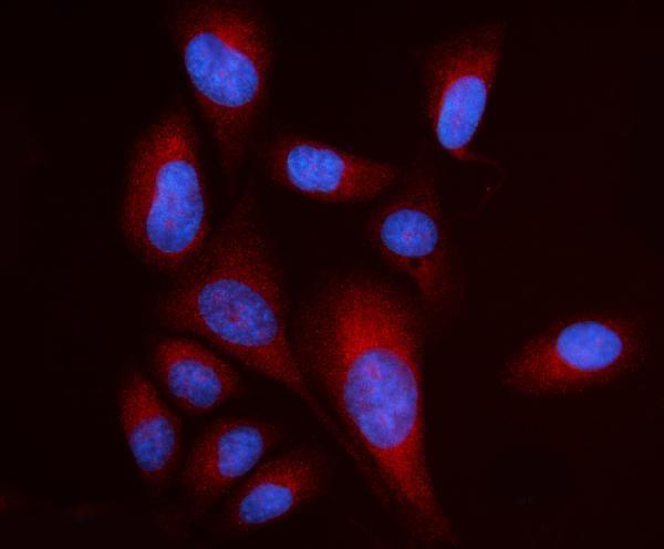 a06980 2 rpl17 primary antibodies if testing 9