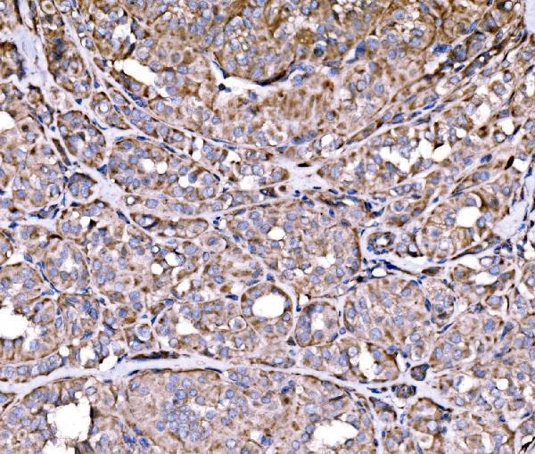 a06980 2 rpl17 primary antibodies ihc testing 2