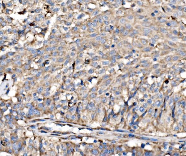 a06980 2 rpl17 primary antibodies ihc testing 3