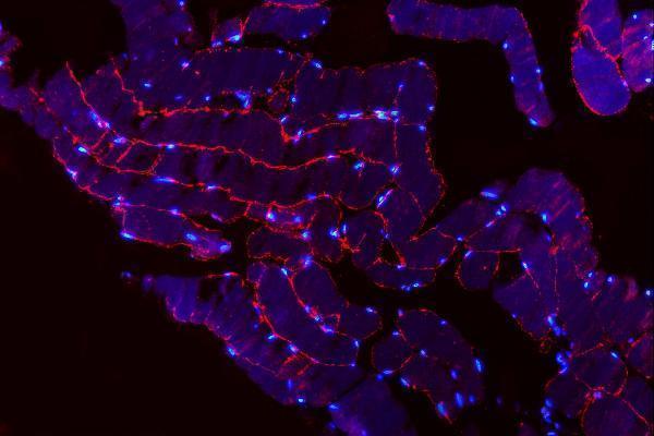 a06982 2 trim72 primary antibodies if testing 5