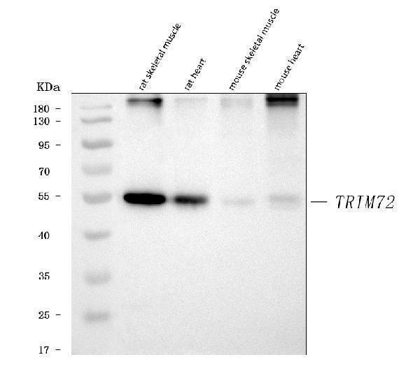  Western blot analysis of MG53/TRIM72 using anti-MG53/TRIM72 antibody (A06982-2)
